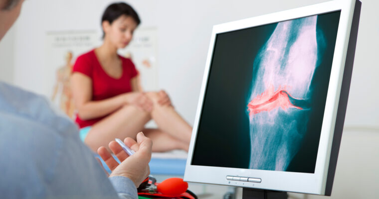 Compléments alimentaires pour l’arthrose : espoir, réalité et conseils pratiques pour soulager vos articulations